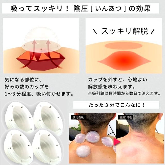 気持ちいいほど吸い付かせて疲労回復！カッピングボール（解脱玉）4個組